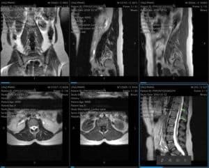 Fisioterapia Prueba de imagen